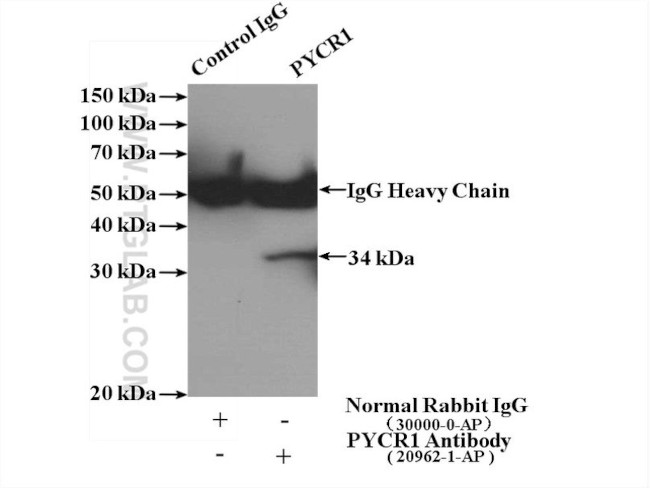 PYCR1 Antibody in Immunoprecipitation (IP)