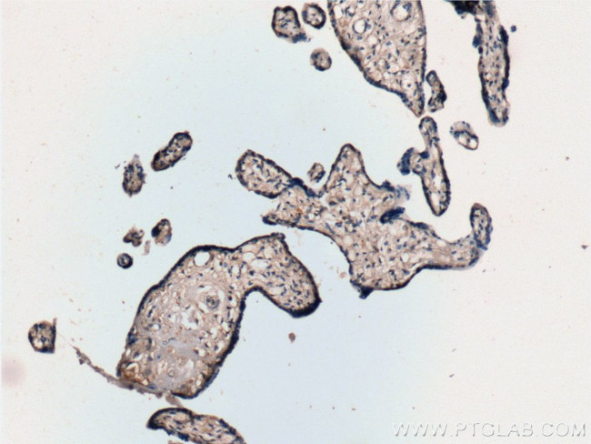 EDNRB Antibody in Immunohistochemistry (Paraffin) (IHC (P))