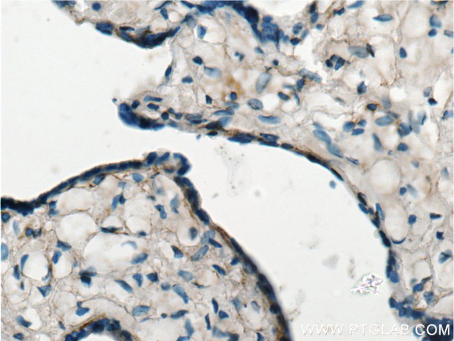 EDNRB Antibody in Immunohistochemistry (Paraffin) (IHC (P))