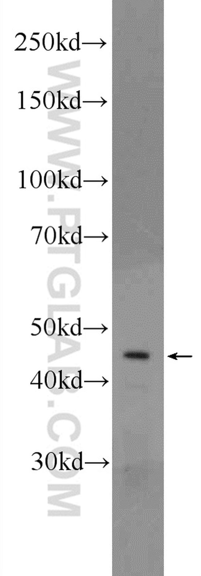 CRHR1 Antibody in Western Blot (WB)