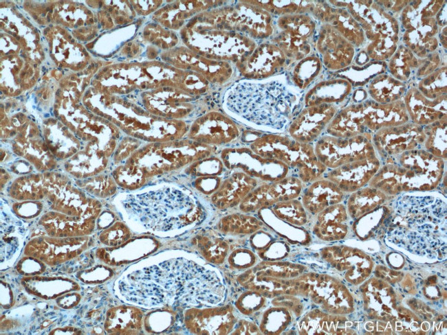 CYP11B2 Antibody in Immunohistochemistry (Paraffin) (IHC (P))