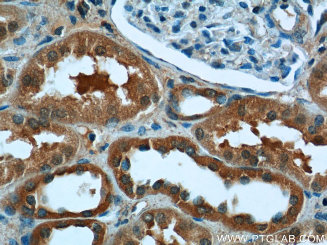 CYP11B2 Antibody in Immunohistochemistry (Paraffin) (IHC (P))