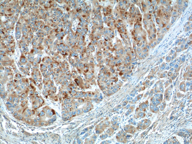 CYP11B2 Antibody in Immunohistochemistry (Paraffin) (IHC (P))