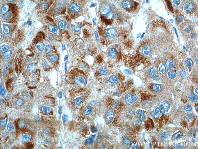 CYP11B2 Antibody in Immunohistochemistry (Paraffin) (IHC (P))