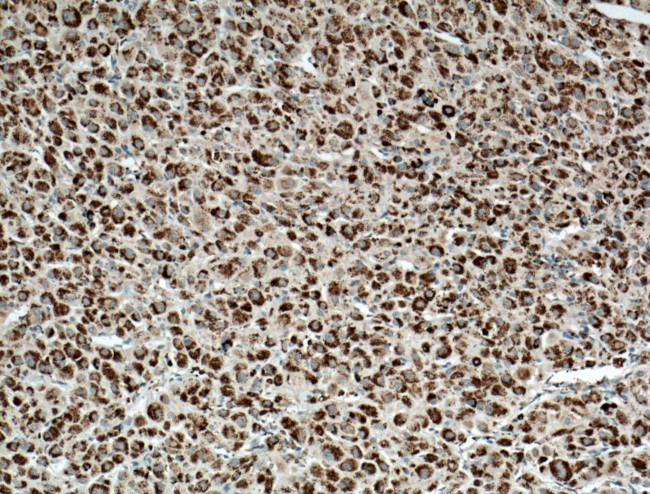 CYP11B2 Antibody in Immunohistochemistry (Paraffin) (IHC (P))