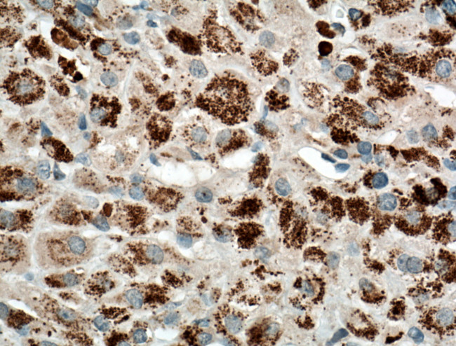 CYP11B2 Antibody in Immunohistochemistry (Paraffin) (IHC (P))