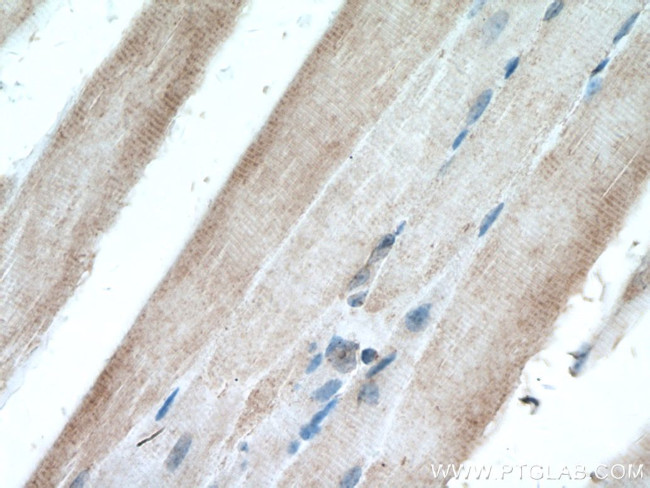 Raptor Antibody in Immunohistochemistry (Paraffin) (IHC (P))