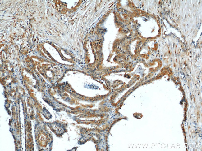 DEPDC6/Deptor Antibody in Immunohistochemistry (Paraffin) (IHC (P))