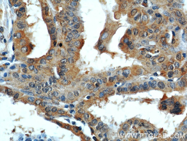 DEPDC6/Deptor Antibody in Immunohistochemistry (Paraffin) (IHC (P))