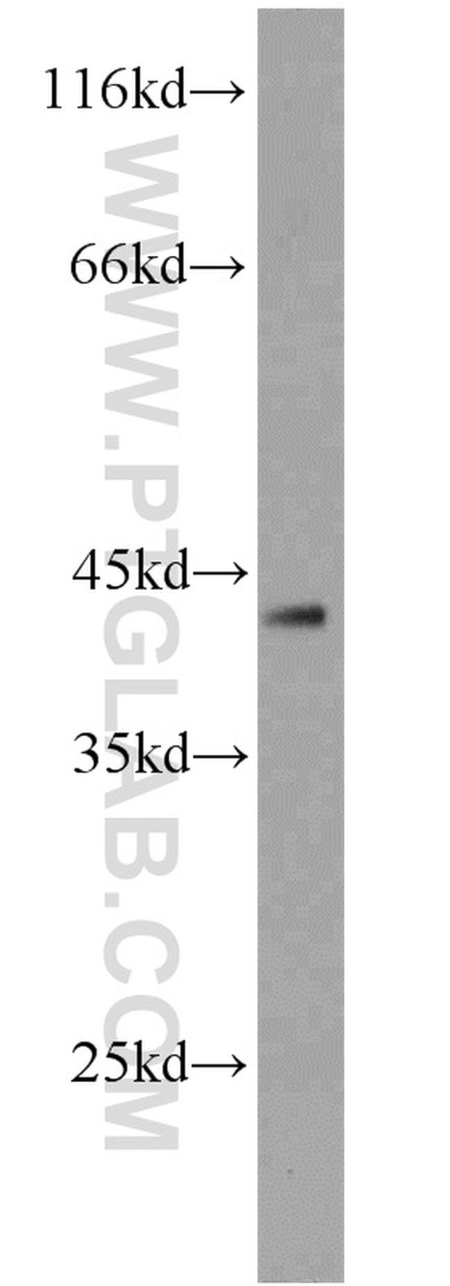 DEPDC6/Deptor Antibody in Western Blot (WB)