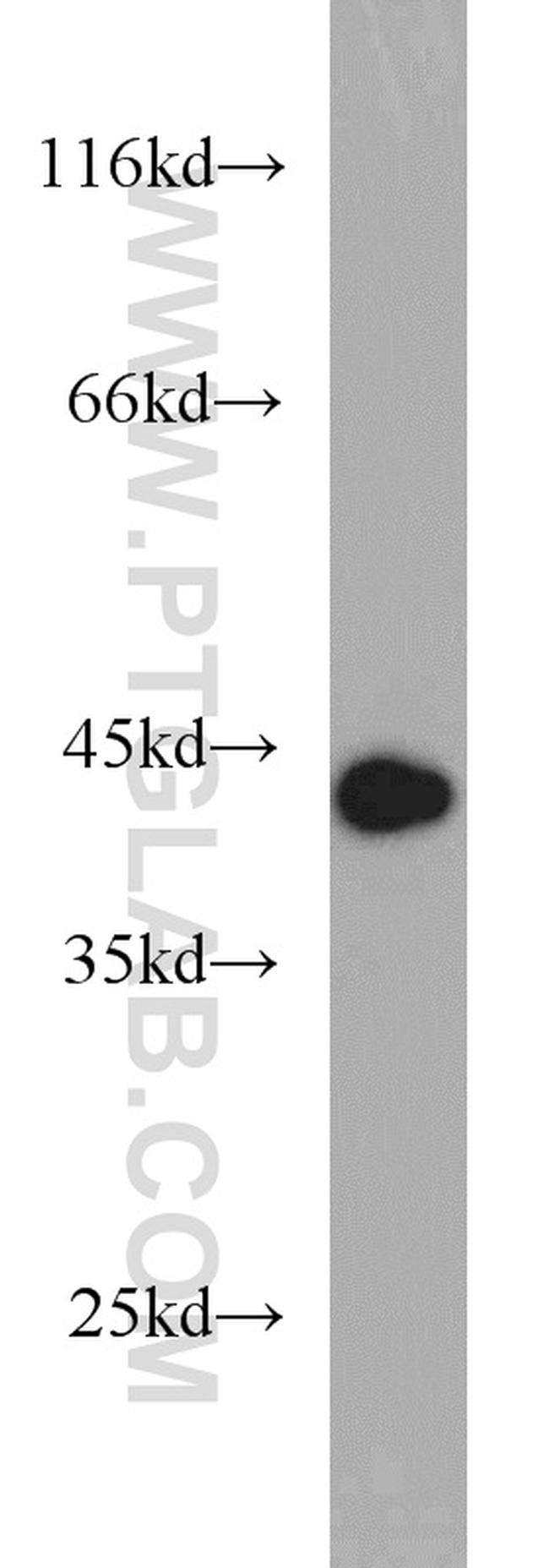 DEPDC6/Deptor Antibody in Western Blot (WB)