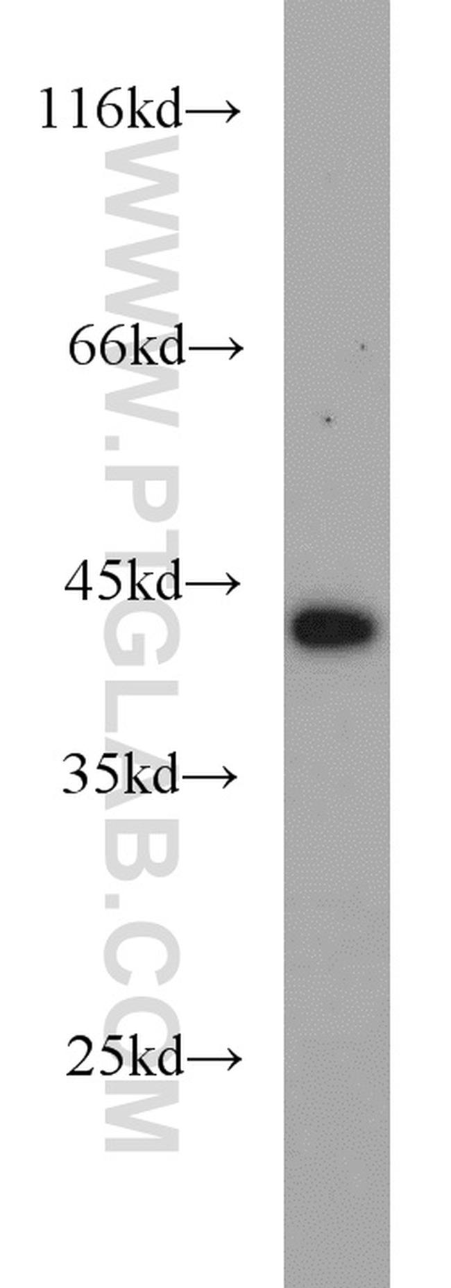 DEPDC6/Deptor Antibody in Western Blot (WB)