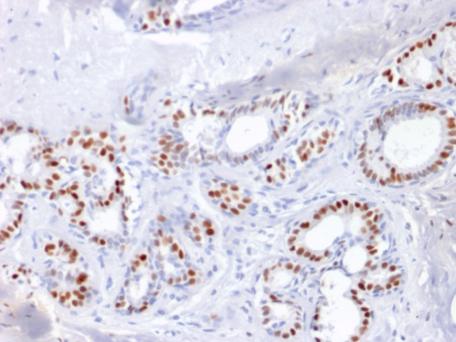 Estrogen Receptor, alpha (Marker of Estrogen Dependence) Antibody in Immunohistochemistry (Paraffin) (IHC (P))