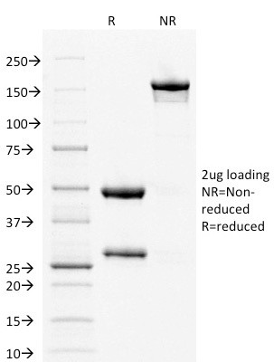 Estrogen Receptor, alpha (Marker of Estrogen Dependence) Antibody in SDS-PAGE (SDS-PAGE)