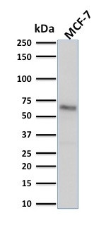 Estrogen Receptor, alpha (Marker of Estrogen Dependence) Antibody in Western Blot (WB)