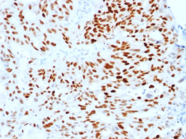 Estrogen Receptor, alpha (Marker of Estrogen Dependence) Antibody in Immunohistochemistry (Paraffin) (IHC (P))