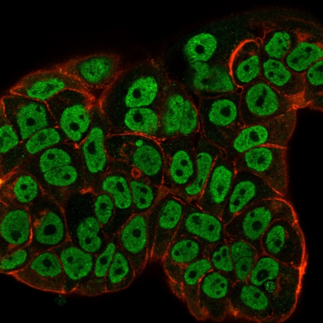 Estrogen Receptor, alpha (Marker of Estrogen Dependence) Antibody in Immunocytochemistry (ICC/IF)