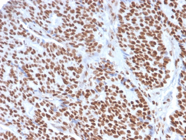 Estrogen Receptor, alpha (Marker of Estrogen Dependence) Antibody in Immunohistochemistry (Paraffin) (IHC (P))