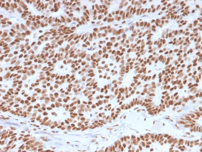 Estrogen Receptor, alpha (Marker of Estrogen Dependence) Antibody in Immunohistochemistry (Paraffin) (IHC (P))