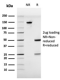 Estrogen Receptor, alpha (Marker of Estrogen Dependence) Antibody in SDS-PAGE (SDS-PAGE)