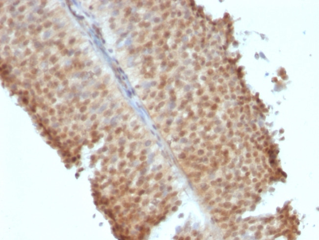 ER-beta-1 (Estrogen Receptor beta-1) Antibody in Immunohistochemistry (Paraffin) (IHC (P))