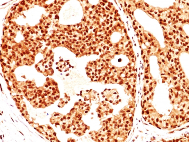 ER-beta-1 (Estrogen Receptor beta-1) Antibody in Immunohistochemistry (Paraffin) (IHC (P))