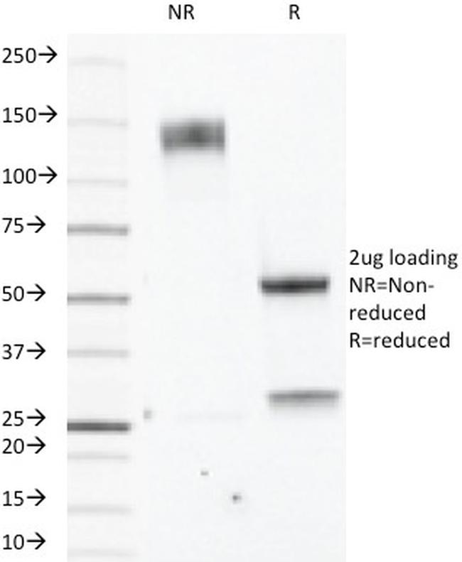 ER-beta-1 (Estrogen Receptor beta-1) Antibody in SDS-PAGE (SDS-PAGE)