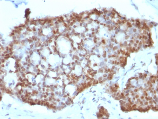 ER-beta-1 (Estrogen Receptor beta-1) Antibody in Immunohistochemistry (Paraffin) (IHC (P))