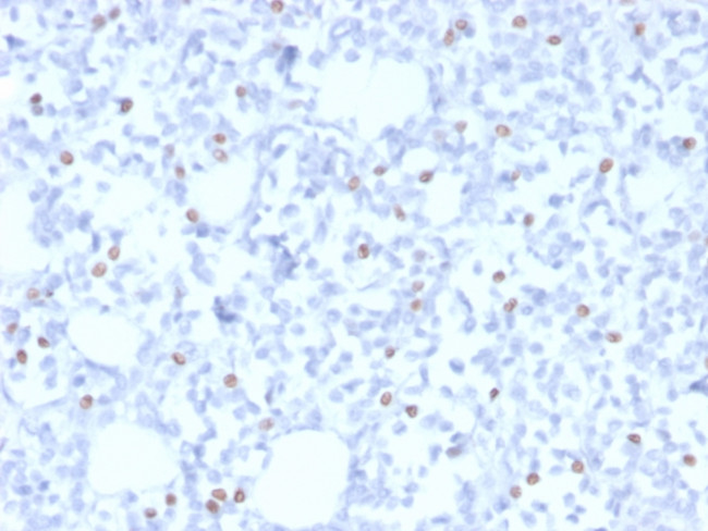 ER-beta (Estrogen Receptor beta-1) Antibody in Immunohistochemistry (Paraffin) (IHC (P))