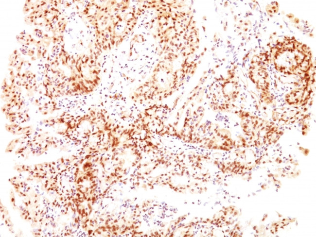 ER-beta-1 (Estrogen Receptor beta-1) Antibody in Immunohistochemistry (Paraffin) (IHC (P))