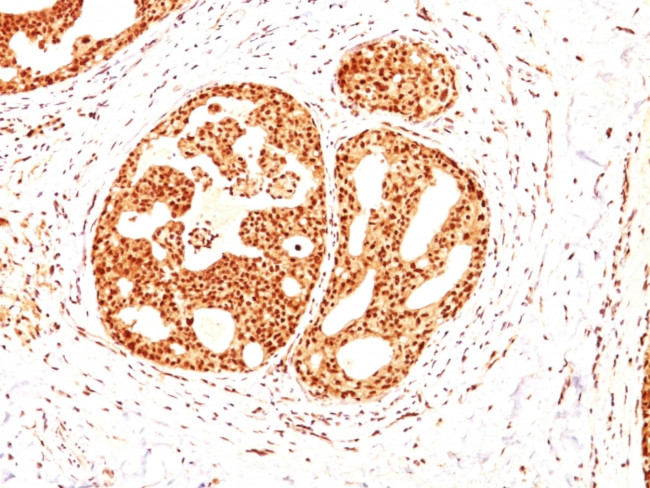 ER-beta-1 (Estrogen Receptor beta-1) Antibody in Immunohistochemistry (Paraffin) (IHC (P))