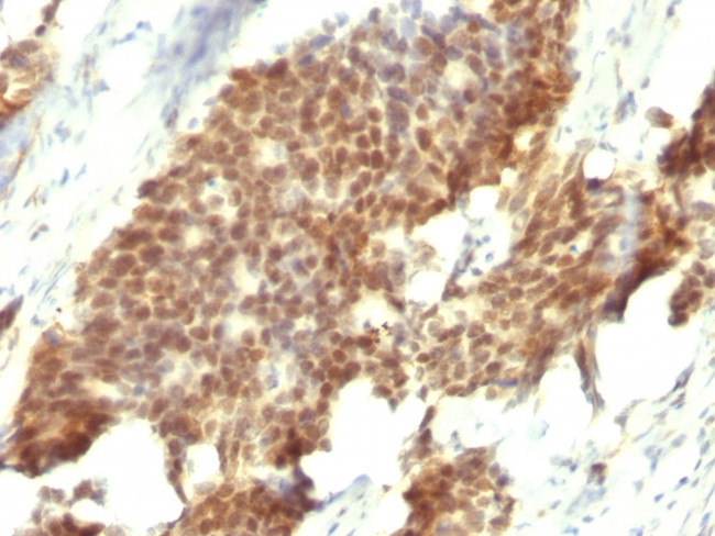 ER-beta-1 (Estrogen Receptor beta-1) Antibody in Immunohistochemistry (Paraffin) (IHC (P))