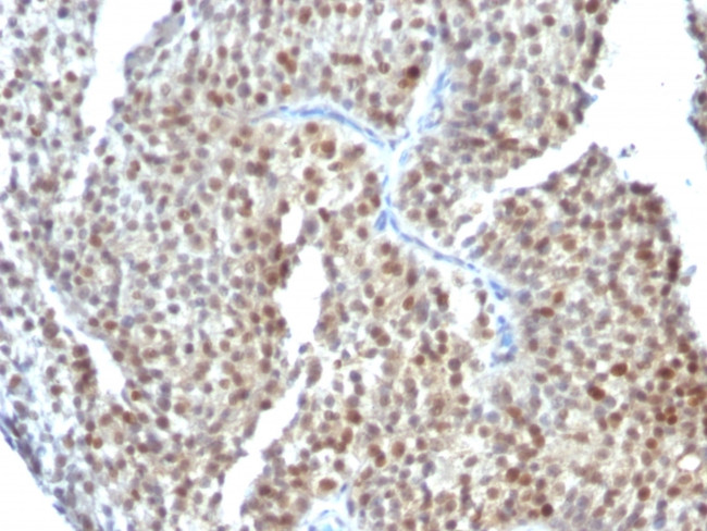 ER-beta-1 (Estrogen Receptor beta-1) Antibody in Immunohistochemistry (Paraffin) (IHC (P))