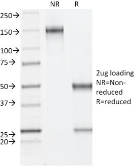 ER-beta-1 (Estrogen Receptor beta-1) Antibody in SDS-PAGE (SDS-PAGE)