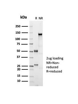 ER-beta-1 (Estrogen Receptor beta-1) Antibody in SDS-PAGE (SDS-PAGE)