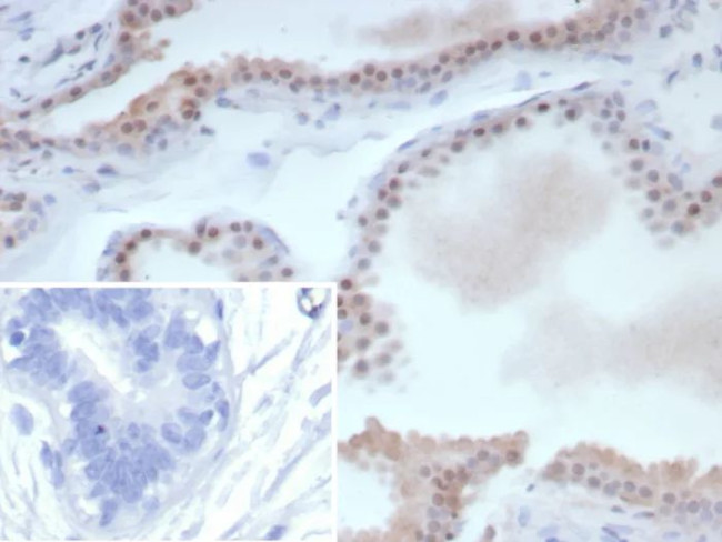 ER-beta (Estrogen Receptor beta-1) Antibody in Immunohistochemistry (Paraffin) (IHC (P))