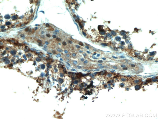 PDXDC1 Antibody in Immunohistochemistry (Paraffin) (IHC (P))