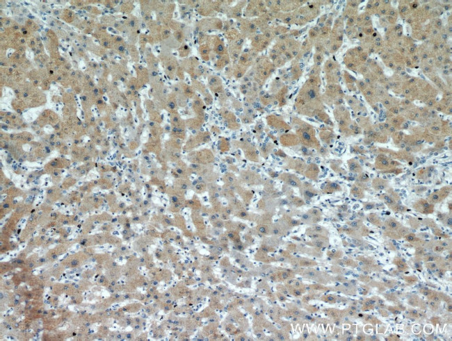 PDXDC1 Antibody in Immunohistochemistry (Paraffin) (IHC (P))