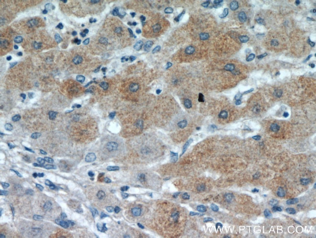 PDXDC1 Antibody in Immunohistochemistry (Paraffin) (IHC (P))