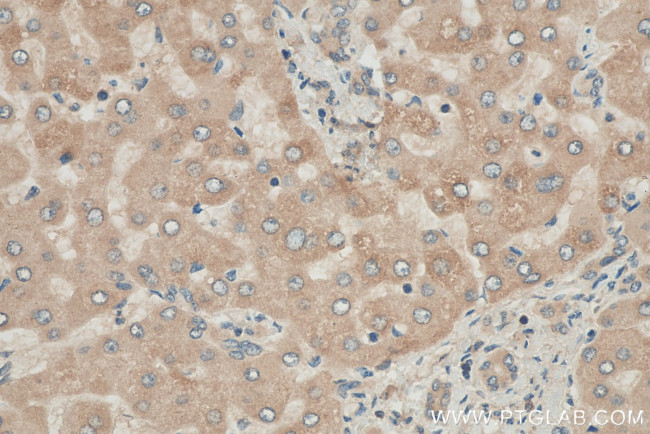 PDXDC1 Antibody in Immunohistochemistry (Paraffin) (IHC (P))