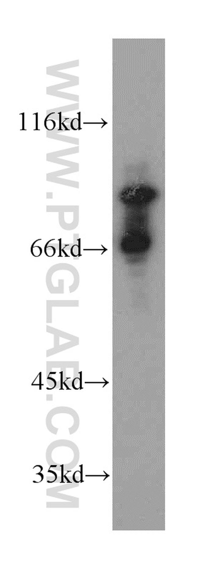 PDXDC1 Antibody in Western Blot (WB)