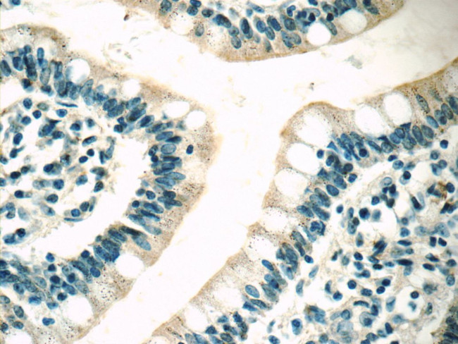 MC3R Antibody in Immunohistochemistry (Paraffin) (IHC (P))