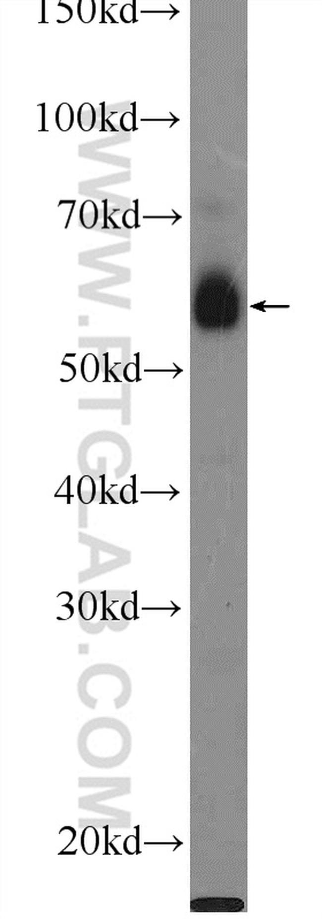 C1orf92 Antibody in Western Blot (WB)