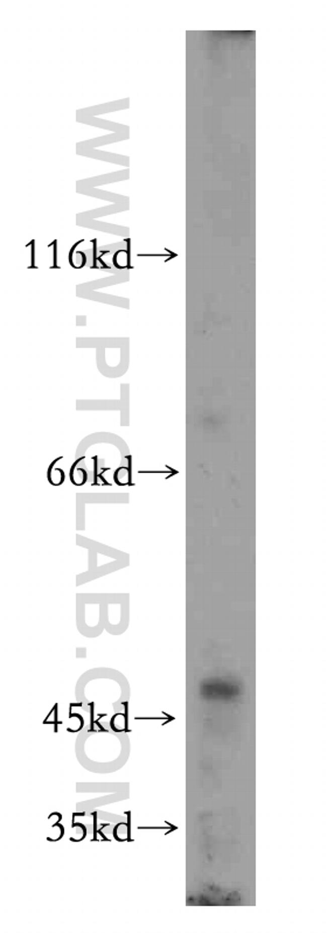 MFSD7 Antibody in Western Blot (WB)