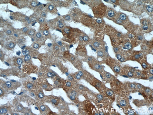 PML Antibody in Immunohistochemistry (Paraffin) (IHC (P))