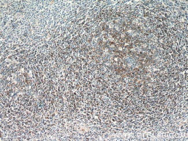 CD37 Antibody in Immunohistochemistry (Paraffin) (IHC (P))