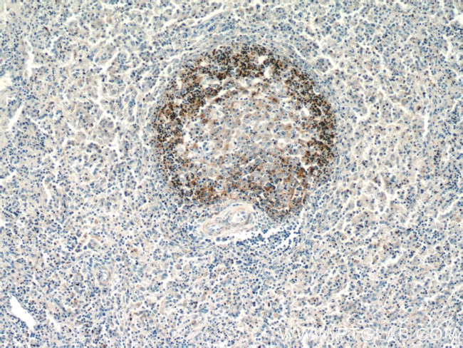 CD37 Antibody in Immunohistochemistry (Paraffin) (IHC (P))