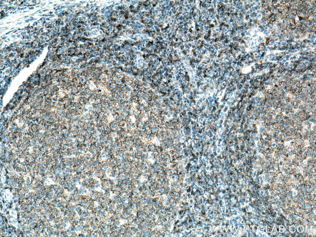 CD37 Antibody in Immunohistochemistry (Paraffin) (IHC (P))