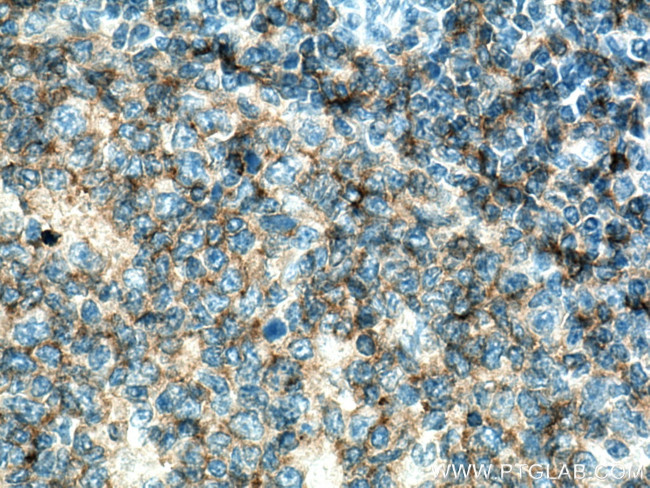 CD37 Antibody in Immunohistochemistry (Paraffin) (IHC (P))