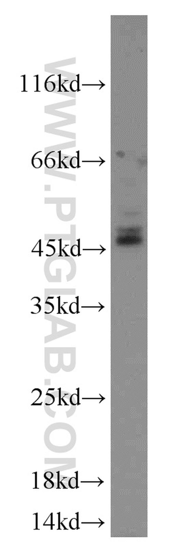 CD37 Antibody in Western Blot (WB)